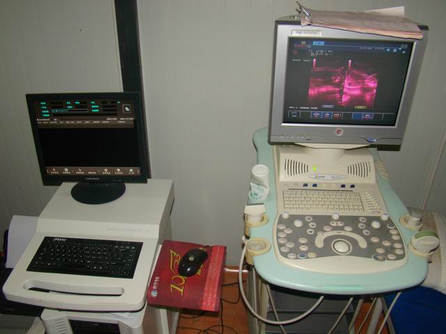 超声影像科室设备(图1)